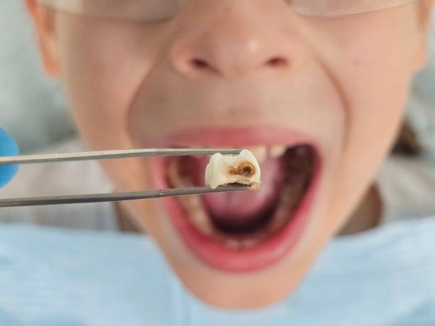 Best Same-Day Emergency Dentist in Hot Springs, AR