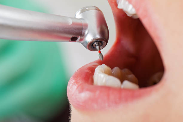 Best Walk-In Emergency Dentist in Hot Springs, AR